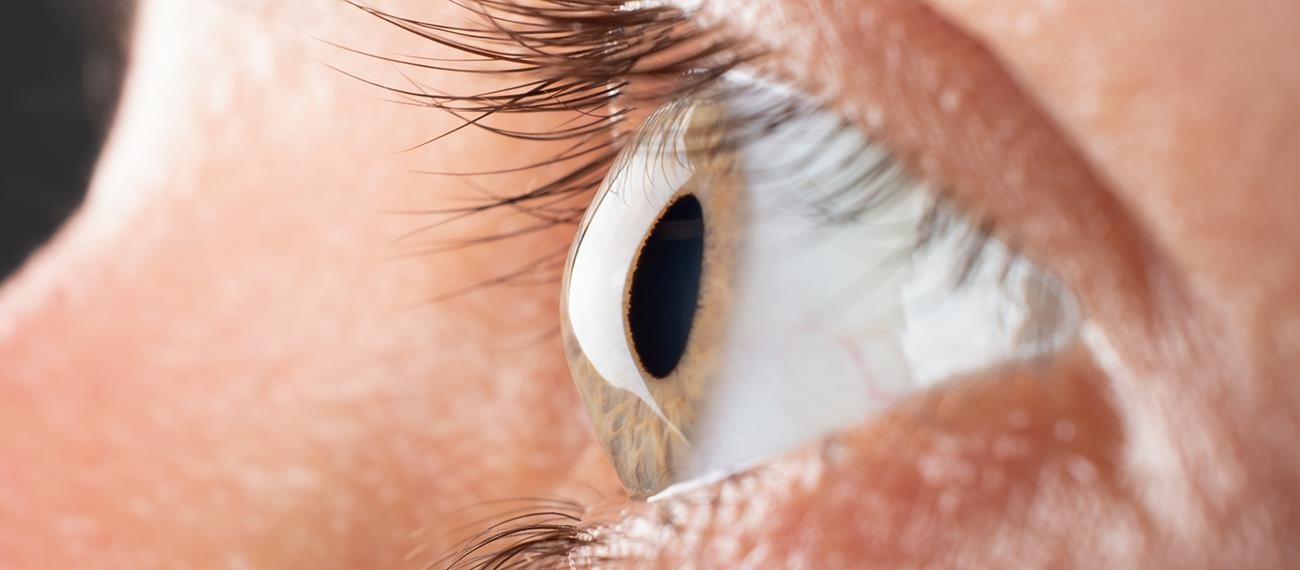 Türkiye’de Keratokonus Prevalansı